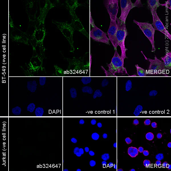 Immunocytochemistry/ Immunofluorescence - Anti-OSMR antibody [RM1322] (AB324647)