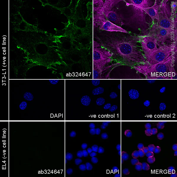 Immunocytochemistry/ Immunofluorescence - Anti-OSMR antibody [RM1322] (AB324647)