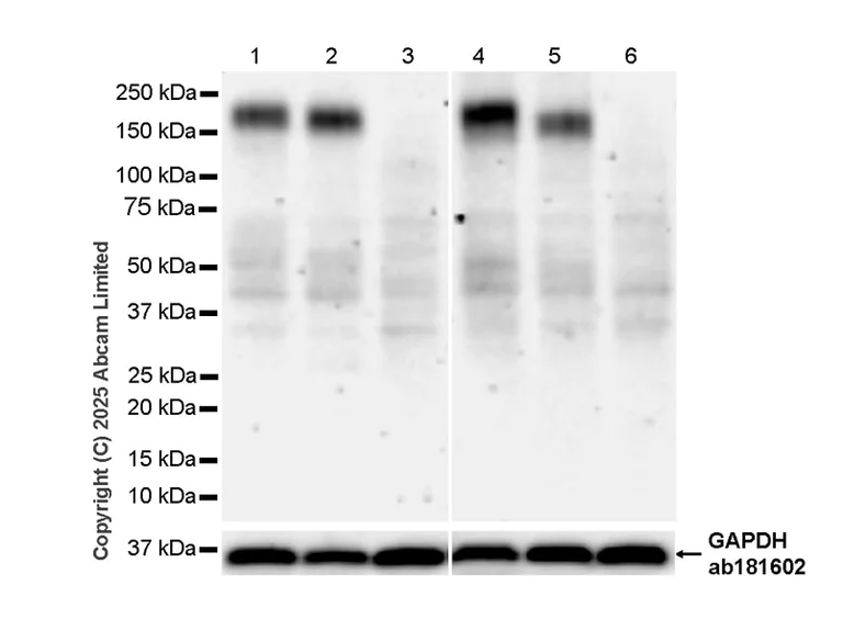 Western blot - Anti-OSMR antibody [RM1322] (AB324647)