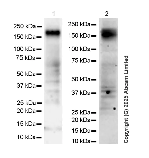 Western blot - Anti-OSMR antibody [RM1322] (AB324647)