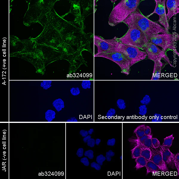 Immunocytochemistry/ Immunofluorescence - Anti-OSMR antibody [RM2085] (AB324099)
