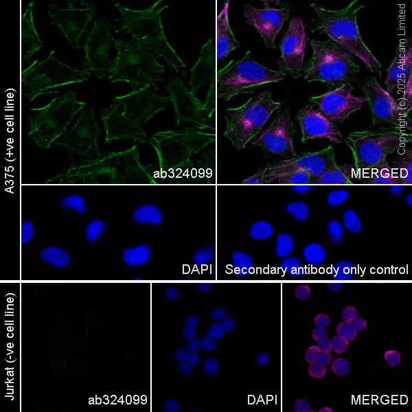 Immunocytochemistry/ Immunofluorescence - Anti-OSMR antibody [RM2085] (AB324099)