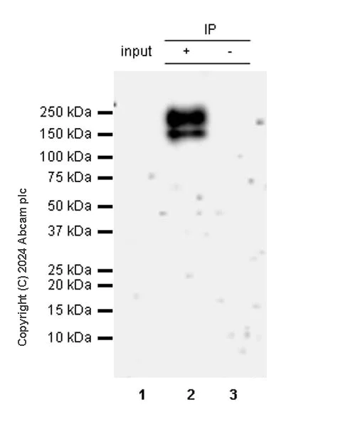 Immunoprecipitation - Anti-OSMR antibody [RM2085] (AB324099)