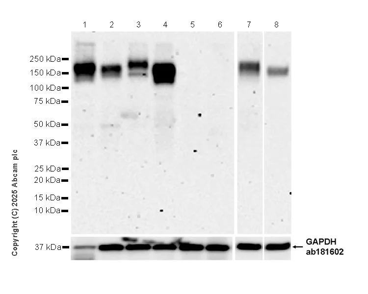 Western blot - Anti-OSMR antibody [RM2085] (AB324099)