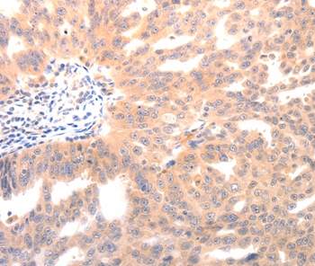 Immunohistochemistry (Formalin/PFA-fixed paraffin-embedded sections) - Anti-Osteocalcin antibody (AB198228)