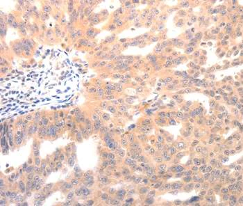 Immunohistochemistry (Formalin/PFA-fixed paraffin-embedded sections) - Anti-Osteocalcin antibody (AB198228)
