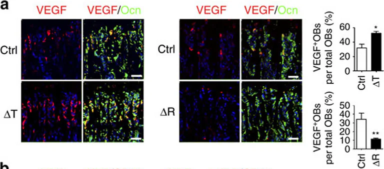 Immunohistochemistry - Anti-Osteocalcin antibody (AB93876)