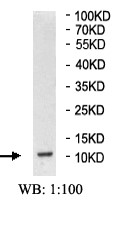 Western blot - Anti-Osteocalcin antibody (AB93876)