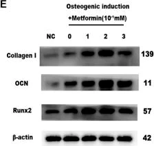 Western blot - Anti-Osteocalcin antibody (AB93876)