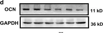 Western blot - Anti-Osteocalcin antibody (AB93876)