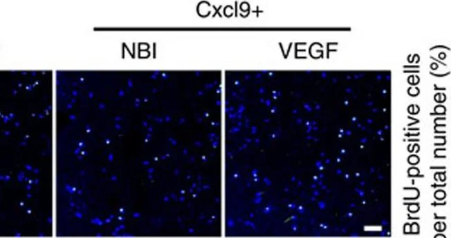 Western blot - Anti-Osteocalcin antibody (AB93876)