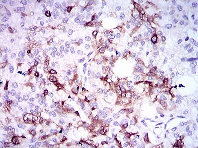Immunohistochemistry (Formalin/PFA-fixed paraffin-embedded sections) - Anti-Osteopontin antibody [7C5H12] (AB166709), expandable thumbnail