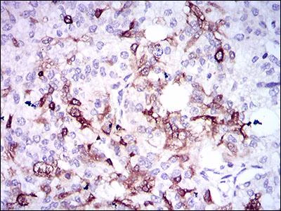 Immunohistochemistry (Formalin/PFA-fixed paraffin-embedded sections) - Anti-Osteopontin antibody [7C5H12] (AB166709)