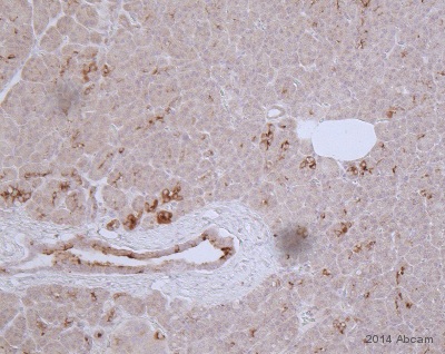 Immunohistochemistry (Formalin/PFA-fixed paraffin-embedded sections) - Anti-Osteopontin antibody [7C5H12] (ab166709), expandable thumbnail