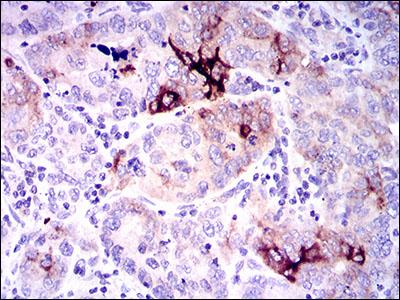 Immunohistochemistry (Formalin/PFA-fixed paraffin-embedded sections) - Anti-Osteopontin antibody [7C5H12] (AB166709), expandable thumbnail