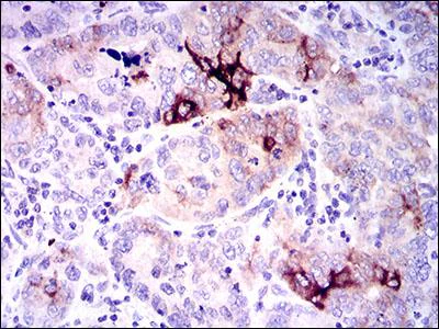 Immunohistochemistry (Formalin/PFA-fixed paraffin-embedded sections) - Anti-Osteopontin antibody [7C5H12] (AB166709)