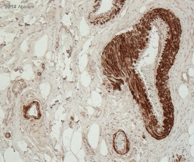 Immunohistochemistry (Formalin/PFA-fixed paraffin-embedded sections) - Anti-Osteopontin antibody [7C5H12] (AB166709), expandable thumbnail