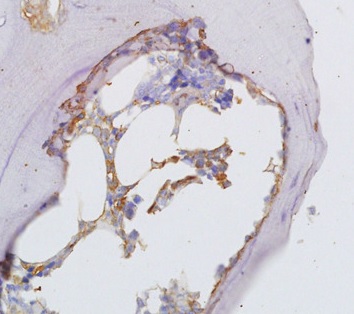 Immunohistochemistry (Formalin/PFA-fixed paraffin-embedded sections) - Anti-Osteopontin antibody (AB216402), expandable thumbnail