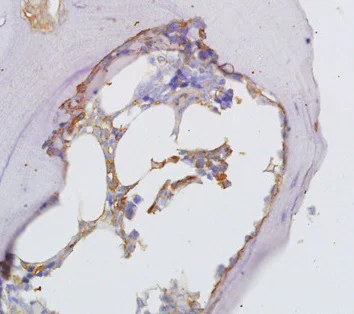 Immunohistochemistry (Formalin/PFA-fixed paraffin-embedded sections) - Anti-Osteopontin antibody (AB216402)