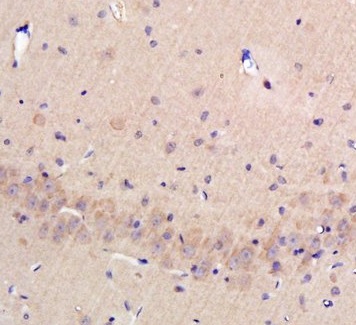 Immunohistochemistry (Formalin/PFA-fixed paraffin-embedded sections) - Anti-Osteopontin antibody (AB216402), expandable thumbnail