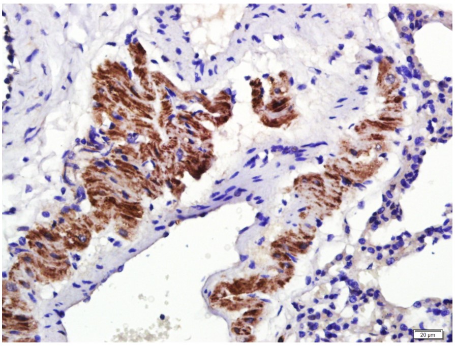 Immunohistochemistry (Formalin/PFA-fixed paraffin-embedded sections) - Anti-Osteopontin antibody (AB216402), expandable thumbnail
