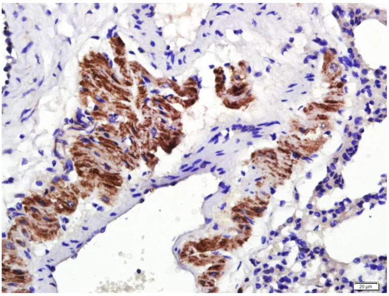 Immunohistochemistry (Formalin/PFA-fixed paraffin-embedded sections) - Anti-Osteopontin antibody (AB216402)