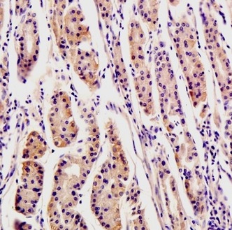 Immunohistochemistry (Formalin/PFA-fixed paraffin-embedded sections) - Anti-Osteopontin antibody (AB216406), expandable thumbnail