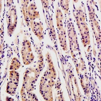 Immunohistochemistry (Formalin/PFA-fixed paraffin-embedded sections) - Anti-Osteopontin antibody (AB216406)