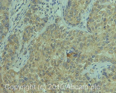 Immunohistochemistry (Formalin/PFA-fixed paraffin-embedded sections) - Anti-Osteopontin antibody (AB63856), expandable thumbnail