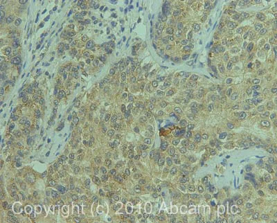 Immunohistochemistry (Formalin/PFA-fixed paraffin-embedded sections) - Anti-Osteopontin antibody (AB63856)