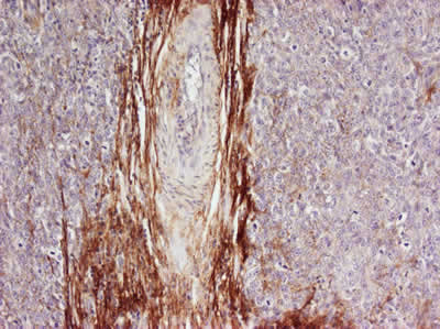 Immunohistochemistry (Formalin/PFA-fixed paraffin-embedded sections) - Anti-Osteopontin antibody (AB8448), expandable thumbnail