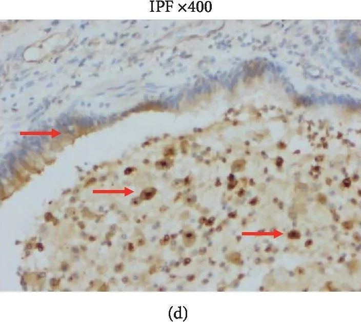 Immunohistochemistry (Formalin/PFA-fixed paraffin-embedded sections) - Anti-Osteopontin antibody (AB8448)