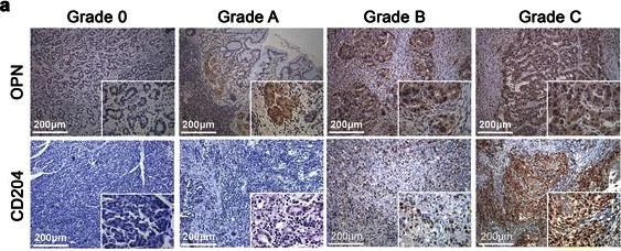 Immunohistochemistry (Formalin/PFA-fixed paraffin-embedded sections) - Anti-Osteopontin antibody (AB8448)
