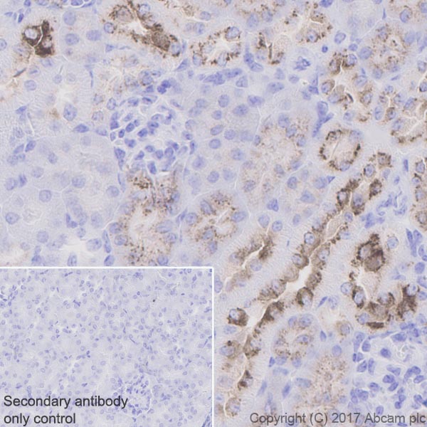 Immunohistochemistry (Formalin/PFA-fixed paraffin-embedded sections) - Anti-Osteopontin antibody [EPR21138] (AB218237), expandable thumbnail