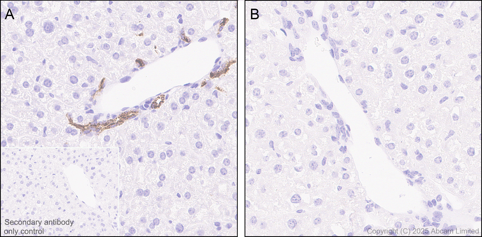 Immunohistochemistry (Formalin/PFA-fixed paraffin-embedded sections) - Anti-Osteopontin antibody [EPR21138] (AB218237)
