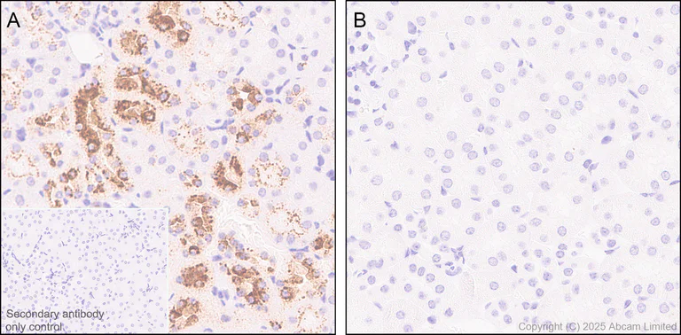 Immunohistochemistry (Formalin/PFA-fixed paraffin-embedded sections) - Anti-Osteopontin antibody [EPR21138] - BSA and Azide free (AB229854)