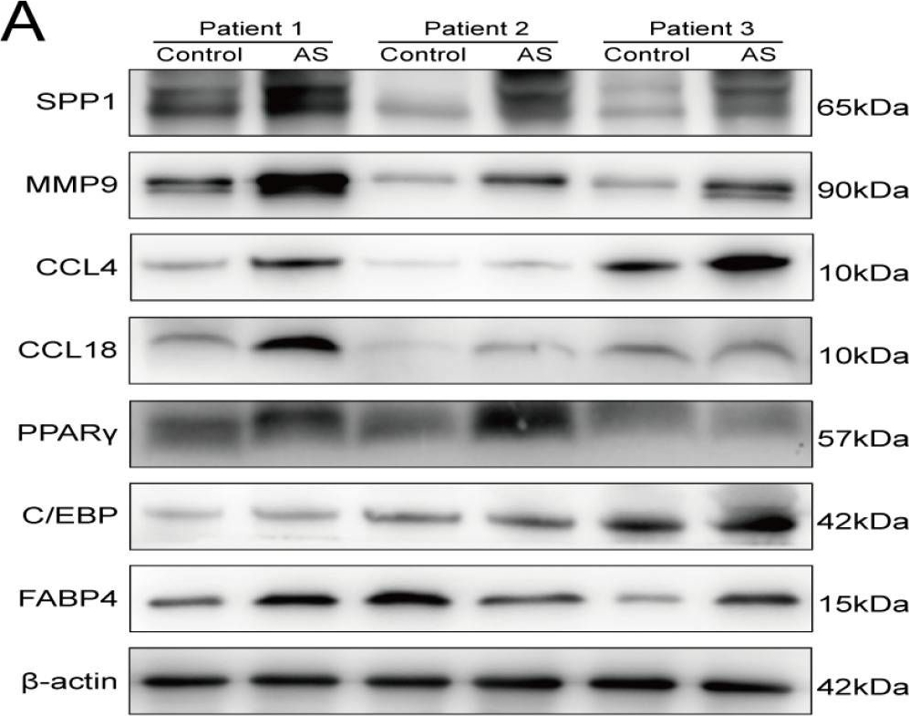 Western blot - Anti-Osteopontin antibody [EPR21139-316] (ab214050), expandable thumbnail