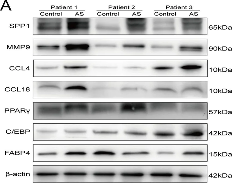 Western blot - Anti-Osteopontin antibody [EPR21139-316] (AB214050)