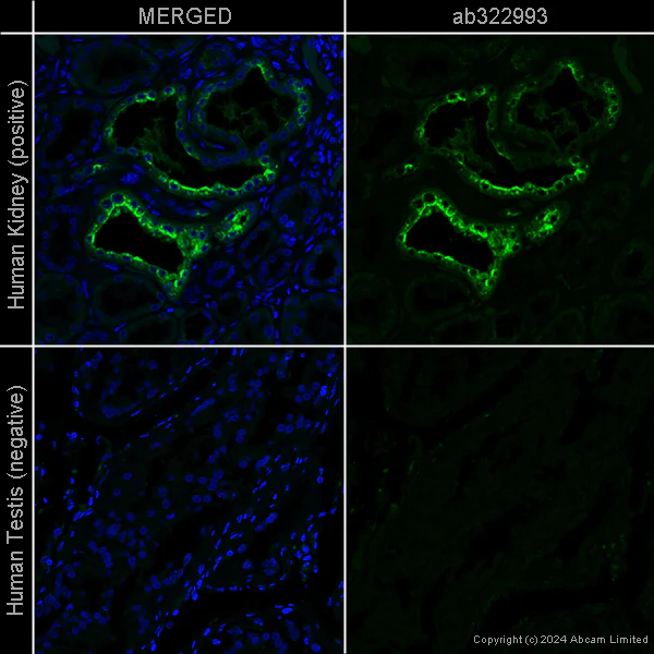 Immunohistochemistry (Formalin/PFA-fixed paraffin-embedded sections) - Anti-Osteopontin antibody [EPR21139-316] - Rat IgG2a (Chimeric) (AB322993)