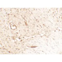 Immunohistochemistry (Formalin/PFA-fixed paraffin-embedded sections) - Anti-Osteopontin antibody - N-terminal (AB181440)