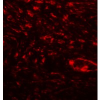 Immunohistochemistry (Formalin/PFA-fixed paraffin-embedded sections) - Anti-Osteopontin antibody - N-terminal (AB181440)