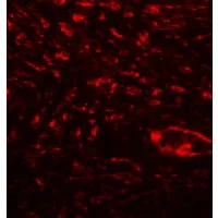Immunohistochemistry (Formalin/PFA-fixed paraffin-embedded sections) - Anti-Osteopontin antibody - N-terminal (AB181440)