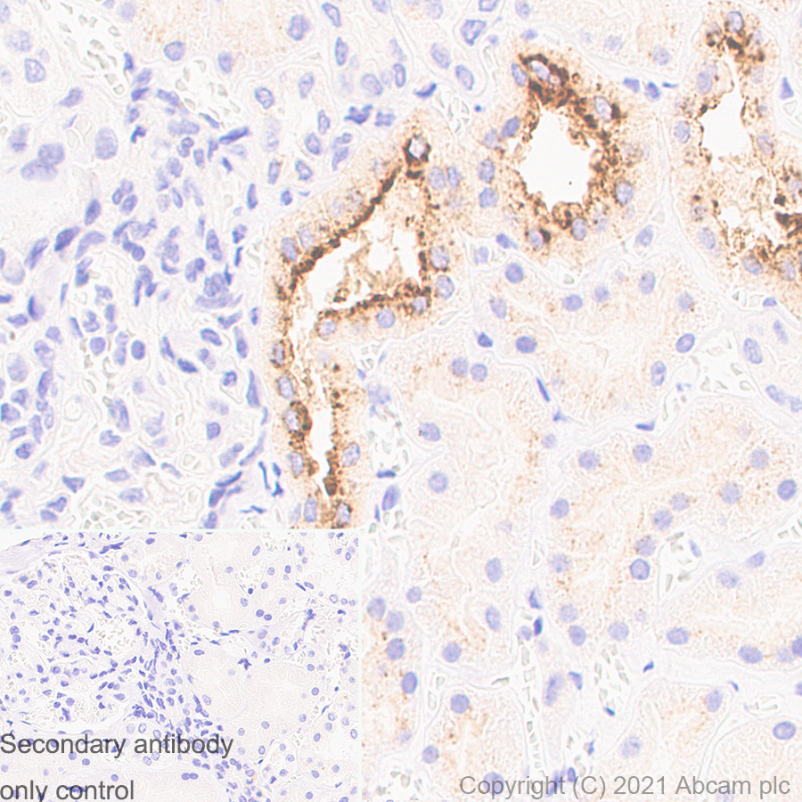 Immunohistochemistry (Formalin/PFA-fixed paraffin-embedded sections) - Anti-Osteopontin antibody [RM1018] (AB283656), expandable thumbnail