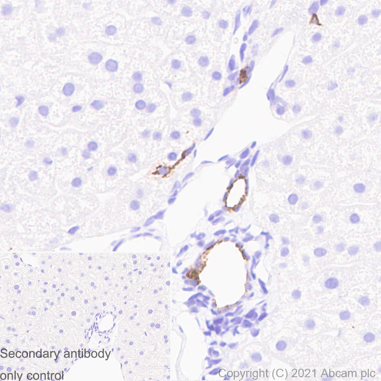 Immunohistochemistry (Formalin/PFA-fixed paraffin-embedded sections) - Anti-Osteopontin antibody [RM1018] (AB283656)