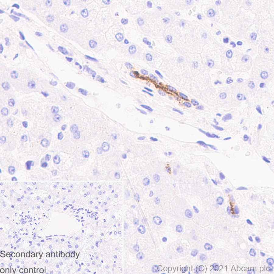 Immunohistochemistry (Formalin/PFA-fixed paraffin-embedded sections) - Anti-Osteopontin antibody [RM1018] (AB283656), expandable thumbnail