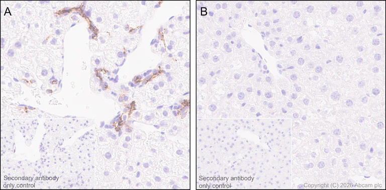 Immunohistochemistry (Formalin/PFA-fixed paraffin-embedded sections) - Anti-Osteopontin antibody [RM1018] (AB283656)