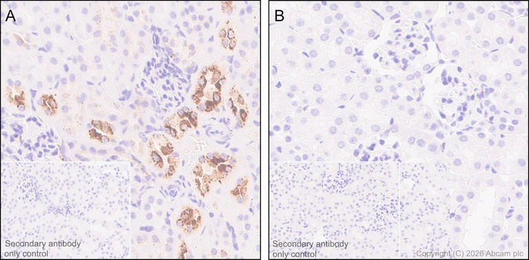 Immunohistochemistry (Formalin/PFA-fixed paraffin-embedded sections) - Anti-Osteopontin antibody [RM1018] (AB283656)