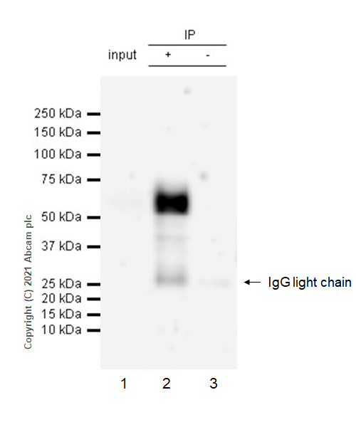 Immunoprecipitation - Anti-Osteopontin antibody [RM1018] (AB283656), expandable thumbnail