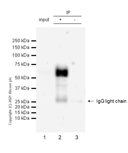 Immunoprecipitation - Anti-Osteopontin antibody [RM1018] (AB283656)