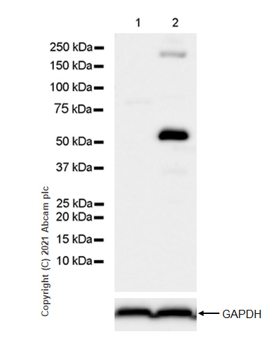 Western blot - Anti-Osteopontin antibody [RM1018] (AB283656), expandable thumbnail